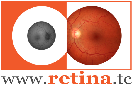 Retina